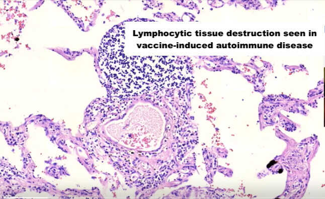 Pathology 1